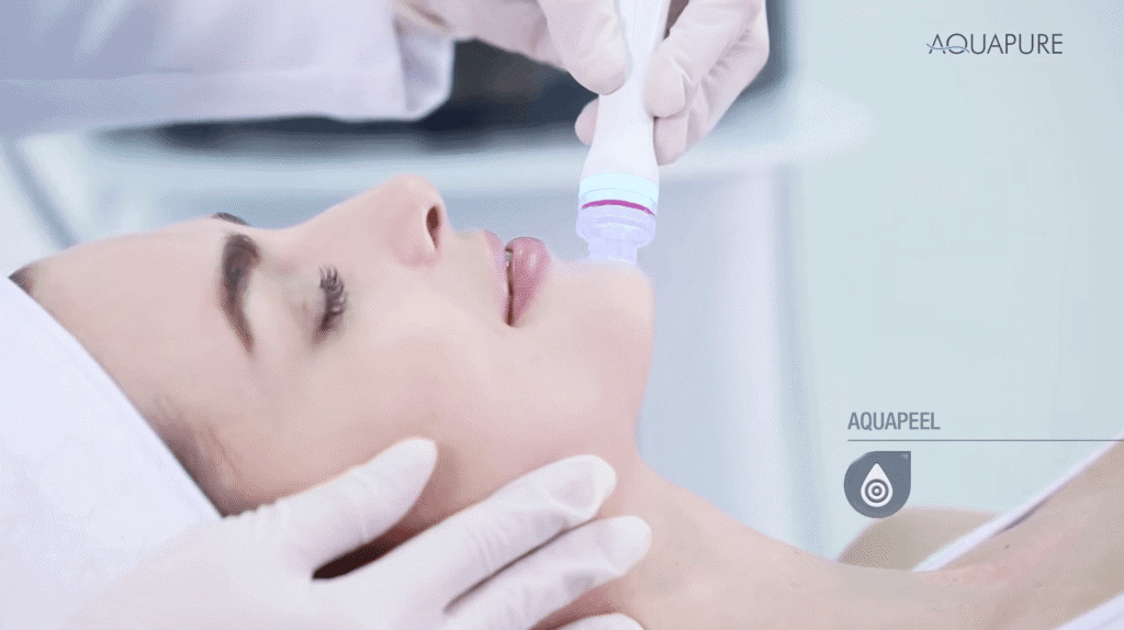 aquapure-aquapeel-2 Aquapure Wrocław Kandara